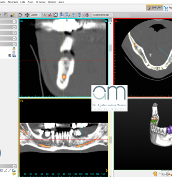 Radiografia digitale